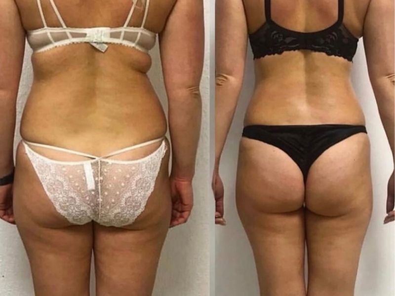 Body Pro Before After Results